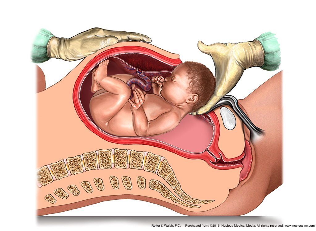 Evotech Scientific Placenta Model with Removable Umbilical