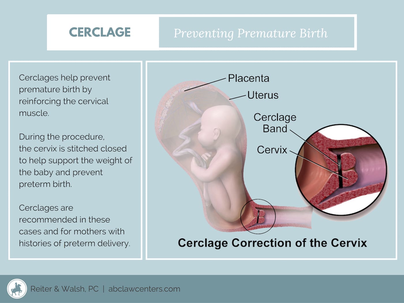 cervix 